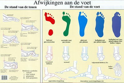 Voeten